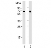 Western blot testing of human 1) liver and 2) lung lysate with IDUA antibody. Expected molecular weight: 74-85 kDa.