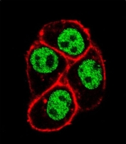 Immunofluorescent staining of fixed and permeabilized human HeLa cells with CDC73 antibody (green) and anti-Actin (red).