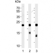 Western blot testing of 1) human ThP-1, 2) mouse liver and 3) rat liver lysate with GPX1 antibody. Predicted molecular weight ~22 kDa.