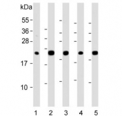 Western blot testing of human 1) liver, 2) HepG2, 3) 293T, 4) kidney and 5) ThP-1 lysate with GPX1 antibody. Predicted molecular weight ~22 kDa.