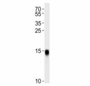 Western blot testing of human HT-1080 cell lysate with IFITM3 antibody. Predicted molecular weight: ~15/17 kDa (unmodified/lipidated).