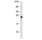 Western blot testing of human ThP-1 cell lysate with NGN3 antibody. Predicted molecular weight ~23 kDa.