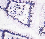 IHC testing of FFPE human small intestine tissue with NGN3 antibody. HIER: steam section in pH6 citrate buffer for 20 min and allow to cool prior to staining.