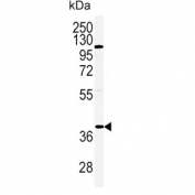 Western blot testing of human HeLa cell lysate with Adiponectin Receptor 2 antibody. Predicted molecular weight ~44 kDa.