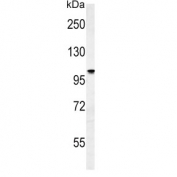 Western blot testing of human MCF7 cell lysate with ATP1A2 antibody. Predicted molecular weight ~112 kDa.