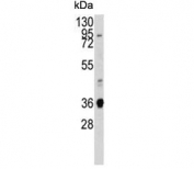 Western blot testing of mouse lung lysate with Annexin A2. Predicted molecular weight ~38 kDa.