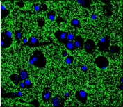 Immunofluorescent staining of human brain tissue with Synaptophysin antibody (green) and DAPI nuclear stain (blue).