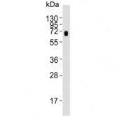 Western blot testing of human MDA-MB-231 cell lysate with CD73 antibody. Predicted molecular weight: 65-70 kDa.