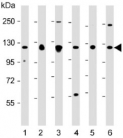 Western blot testing of 1) human skeletal muscle, 2) human A431, 3) human HeLa, 4) mouse kidney, 5) rat PC-12 and 6) human HepG2 lysate with Vinculin antibody. Predicted molecular weight ~124 kDa.