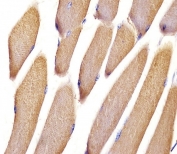 IHC testing of FFPE mouse skeletal muscle tissue with Vinculin antibody. HIER: steam section in pH6 citrate buffer for 20 min and allow to cool prior to staining.