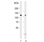 Western blot testing of human 1) placenta and 2) plasma lysate with Autotaxin antibody. Expected molecular weight: 99-125 kDa depending on glycosylation level.