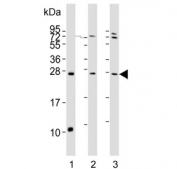 Western blot testing of 1) mouse lung, 2) human liver and 3) human HeLa lysate with Sclerostin antibody. Predicted molecular weight ~24 kDa.