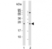 Western blot testing of human 1) kidney and 2) liver lysate with Sclerostin antibody. Predicted molecular weight ~24 kDa.