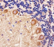 IHC testing of FFPE rat cerebellum tissue with PPT1 antibody. HIER: steam section in pH6 citrate buffer for 20 min and allow to cool prior to staining.