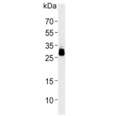 Western blot testing of human HepG2 cell lysate with PPT1 antibody. Predicted molecular weight ~34 kDa.