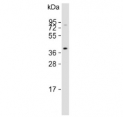 Western blot testing of mouse NIH 3T3 cell lysate with Angiotensin II Type 1 Receptor antibody. Observed molecular weight: 41-50 kDa depending on glycosylation level.