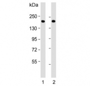 Western blot testing of human 1) lung and 2) plasma lysate with Complement factor H antibody. Predicted molecular weight ~139 kDa but may be observed at a higher molecular weight due to glycosylation.