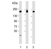 Western blot testing of human 1) MCF7, 2) SK-BR-3 and 3) ThP1 cell lysate with PREX1 antibody. Predicted molecular weight ~186 kDa.