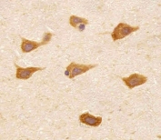 IHC testing of FFPE human brain tissue with PREX1 antibody. HIER: steam section in pH6 citrate buffer for 20 min and allow to cool prior to staining.