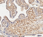 IHC testing of FFPE human placenta tissue with CD276 antibody. HIER: steam section in pH9 EDTA for 20 min and allow to cool prior to staining.