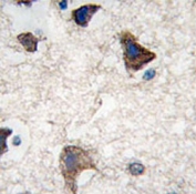 IHC testing of FFPE human brain tissue with Cadherin 4 antibody. HIER: steam section in pH6 citrate buffer for 20 min and allow to cool prior to staining.