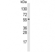 Western blot testing of human T-47D cell lysate with ALDH6A1 antibody. Predicted molecular weight: ~58 kDa.