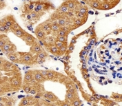 IHC testing of FFPE mouse kidney tissue with Adenylate kinase 4 antibody. HIER: steam section in pH6 citrate buffer for 20 min and allow to cool prior to staining.