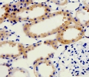 IHC testing of FFPE rat kidney tissue with ADRA1D antibody. HIER: steam section in pH6 citrate buffer for 20 min and allow to cool prior to staining.