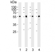 Western blot testing of human 1) A549, 2) LNCaP, 3) PC-3 and 4) rat brain lysate with ADRA1D antibody. Predicted molecular weight ~60 kDa.