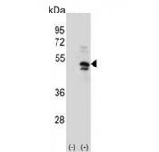 Western blot testing of 1) non-transfected and 2) transfected 293 cell lysate with USP14 antibody.