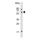 Western blot testing of human HCT-116 cell lysate with USP14 antibody. Predicted molecular weight ~56 kDa.