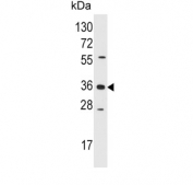 Western blot testing of human Jurkat cell lysate with AKR1B1 antibody. Predicted molecular weight ~36 kDa.