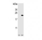 Western blot testing of 1) non-transfected and 2) transfected HEK293 cell lysate with CFL1 antibody.