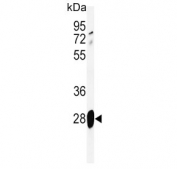 Western blot testing of mouse lung lysate with Adrenomedullin antibody.