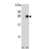 Western blot testing of 1) non-transfected and 2) transfected 293 cell lysate with Pro-MCH antibody. 