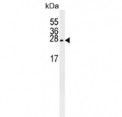 Western blot testing of mouse brain lysate with Pro-MCH antibody.