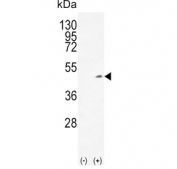 Western blot testing of 1) non-transfected and 2) transfected 293 cell lysate with ADH1C antibody.