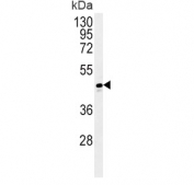 Western blot testing of human T-47D cell lysate with ADH1C antibody. Predicted molecular weight ~40 kDa.