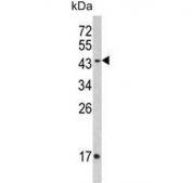 Western blot testing of human MDA-MB-453 lysate with IFNGR2 antibody. Expected molecular weight: 37-55 kDa.