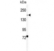 Western blot testing of human HEK293 cell lysate with BCOR antibody. Predicted molecular weight ~192 kDa.