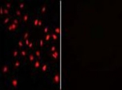 Immunofluorescent staining of human HeLa cells with (left) and without (right) PI4K2A antibody (red).