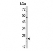 Western blot testing of human HEK293 cell lysate with ATP5O antibody. Predicted molecular weight ~23 kDa.