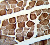 IHC testing of FFPE human skeletal muscle tissue with ATP5O antibody. HIER: steam section in pH6 citrate buffer for 20 min and allow to cool prior to staining.