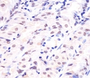 IHC testing of FFPE human stomach tissue with APE1 antibody. HIER: steam section in pH6 citrate buffer for 20 min and allow to cool prior to staining.