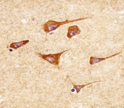 IHC testing of FFPE human brain tissue with Superoxide Dismutase 2 antibody. HIER: steam section in pH6 citrate buffer for 20 min and allow to cool prior to staining.