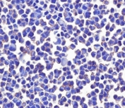 Immunocytochemical testing of PFA-fixed human MCF7 cells with B7-H3 antibody. HIER: pH9 EDTA.