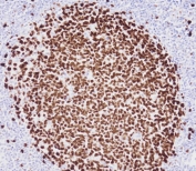 IHC testing of FFPE human tonsil tissue with Ki67 antibody. HIER: steam section in pH9 EDTA for 20 min and allow to cool prior to staining.