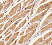 IHC testing of FFPE human heart tissue with zebrafish Ak2 antibody. HIER: steam section in pH6 citrate buffer for 20 min and allow to cool prior to staining.