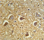 IHC testing of FFPE human brain tissue with Hyaluronan synthase 2 antibody. HIER: steam section in pH6 citrate buffer for 20 min and allow to cool prior to staining.