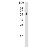 Western blot testing of rat kidney lysate with CYP27B1 antibody. Predicted molecular weight ~57 kDa.